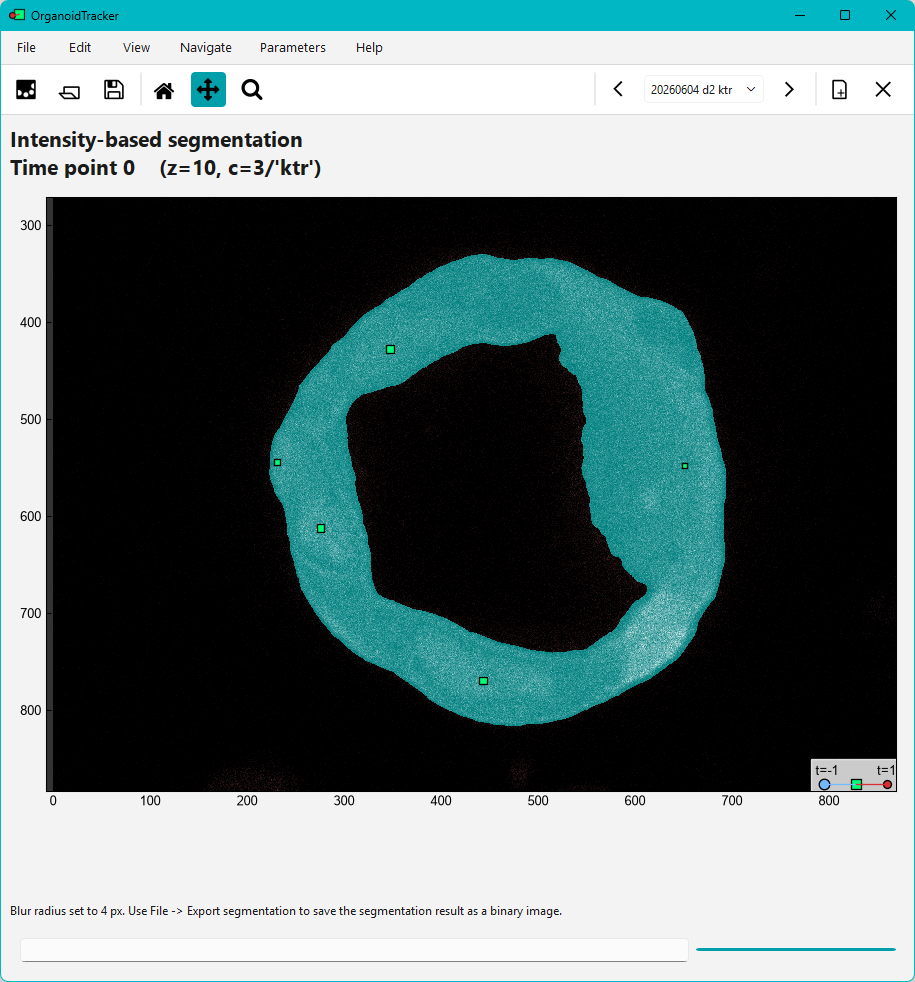 Intensity-based segmentation